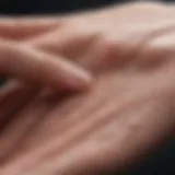 Blister formation on skin due to friction
