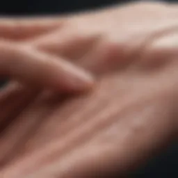 Blister formation on skin due to friction