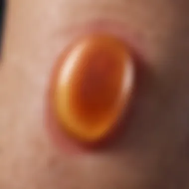 Detailed view of a blister on skin